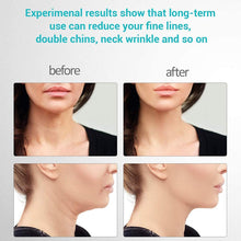 Load image into Gallery viewer, LemiTech Skin™ - Skin Rejuvenating Device
